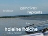 réduction sur le blanchiment de dents